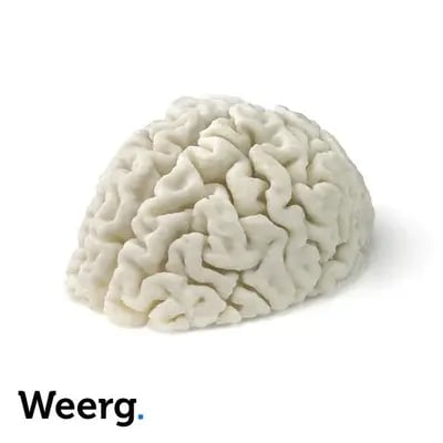 modello anatomico cervello stampato in 3d
